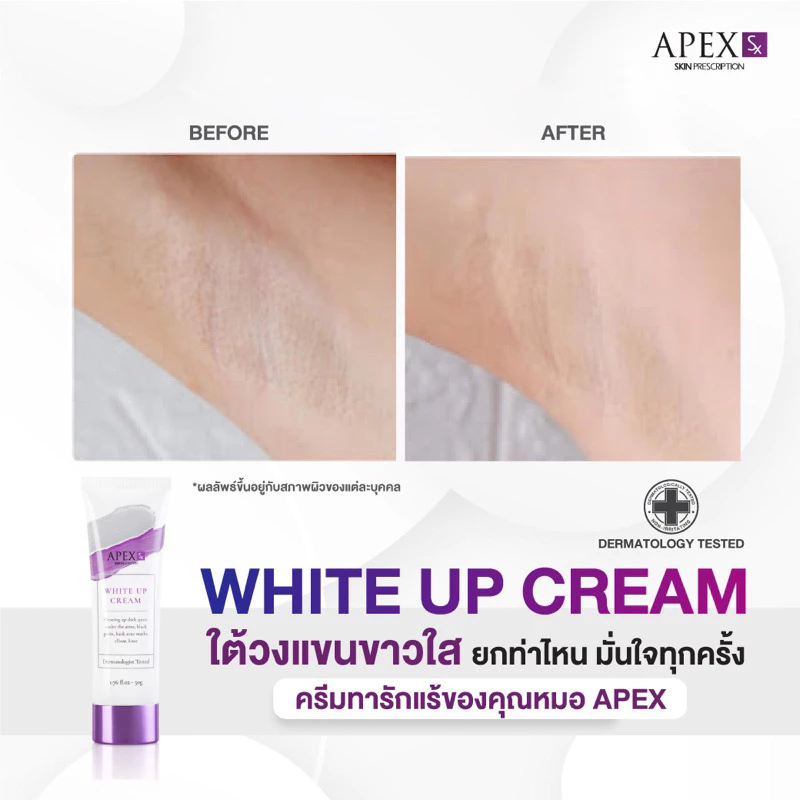 APEX-SX WHITE UP CREAM ครีมทารักแร้ขาว โดยแพทย์ผิวหนังเอเพ็กซ์ ทาขาหนีบดำ แก้มก้นดำ 50 ml. thumbnail 6