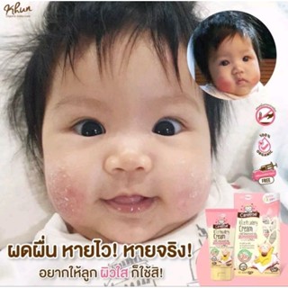 ครีมแป้ง ลดผดผื่น แครี่บี ไรซ์พาวเดอรี่ 35 กรัม สูตรแห้งไว