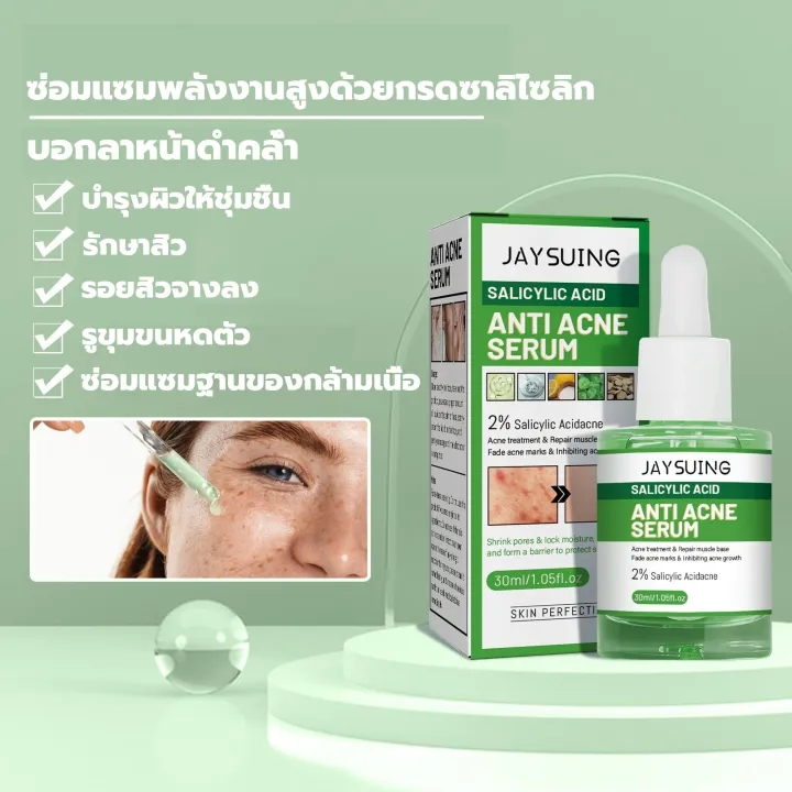 Jayusing ครีมแต้มสิว ลดสิวอุดตัน ละลายหัวสิว ช่วยลดรอยสิว ไม่อุดตันผิว รูขุมขนกระชับ ครีมลดรอยสิว เจลแต้มสิว เซรั่มลดสิว