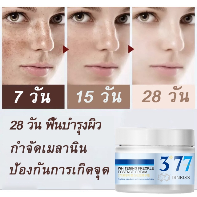 DinKiss377❤ไวท์เทนนิ่งลบกระ  titok ขายร้อน❤ ครีมทาฝ้า ไวท์เทนนิ่งครีมกระ การกำจัดที่มีประสิทธิภาพ ฝ้