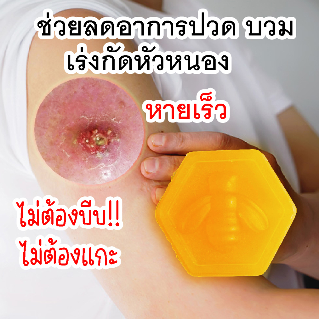 โปรพิเศษสำหรับคนเป็นฝีชุดสบู่ดูแลป้องกันยับยั้งฝีหนองทุกชนิดให้ฟอกฝีทุกวัน
