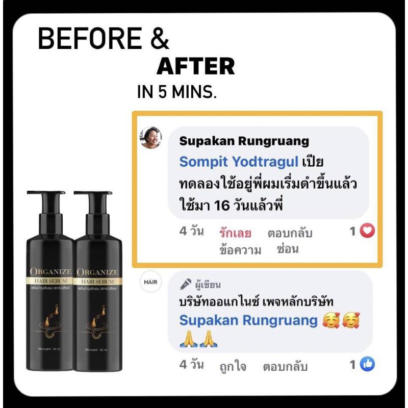 เซรั่มแก้ผมหงอก ป้องกันผมร่วง - รูปที่ 5