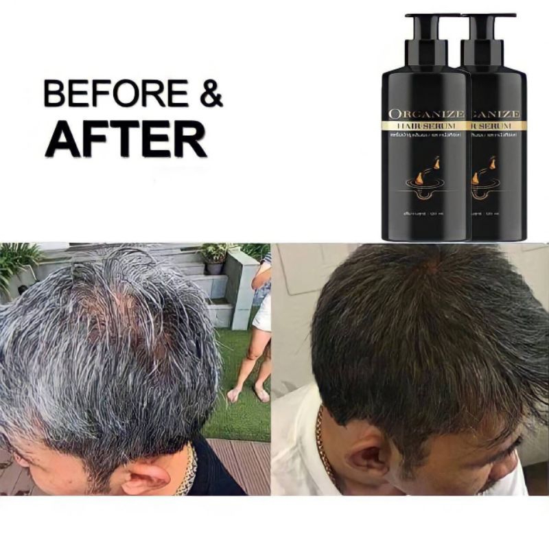 เซรั่มแก้ผมหงอก ป้องกันผมร่วง - รูปที่ 3