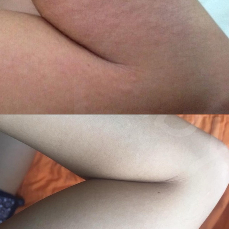 OPO | Rabye Mineral​ Shower สบู่เหลวน้ำแร่ ลดผดผื่นคัน​ ผิวอักเสบแดง แพ้ง่าย​ น้ำเหลืองไม่ดี ราคา ถูกที่สุด ดีลบีเคเค แกลเลอรีภาพที่ 8