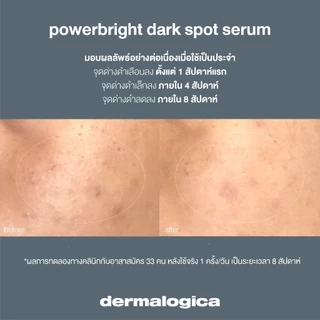 Dermalogica PowerBright Dark Spot Serum 30ml เดอร์มาลอจิกา พาวเวอร์ไบรท ดาร์ค สป็อท เซรั่ม ลดฝ้า กระ จุดด่างดำ รอยสิว