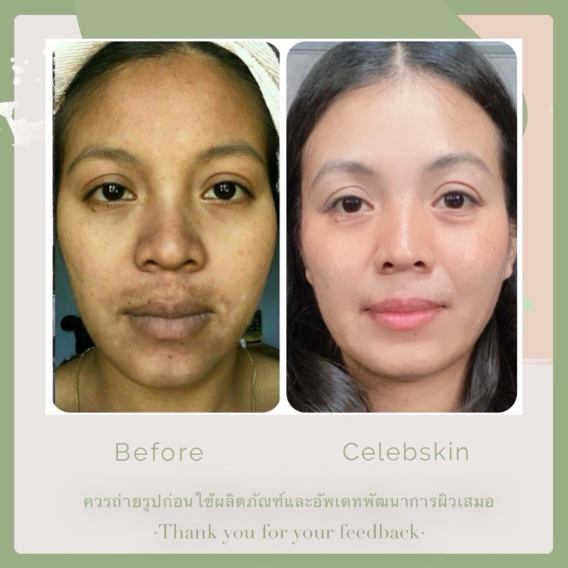 CELEB SKIN HAPPINESS น้ำมันบำรุงผิว Co-Q10 10g รูปที่ 6