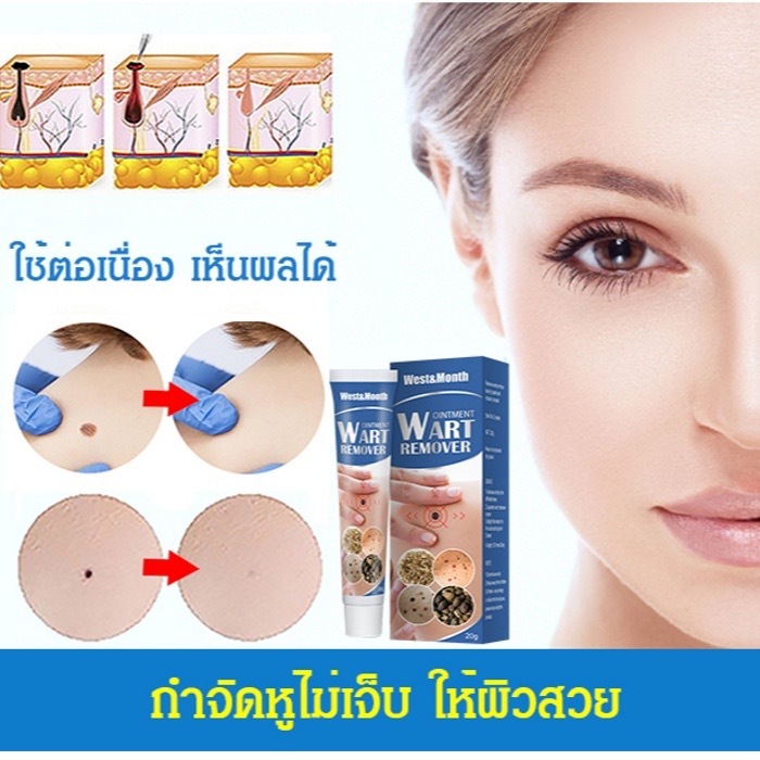 💲สามารถใช้ได้ทั้งชายและหญิงทุกวัย✨ Wart removal ติ่งเนื้อ ทาไฝ ทาขี้แมลงวัน wart removal cream
