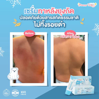 Exp 12/26 หลอดใหญ่ 40g. Mama Tales เซรั่มทาหลังยุงกัด ลดรอยแดง สำหรับเด็ก ใช้ได้ตั้งแต่แรกเกิด Soothing Serum
