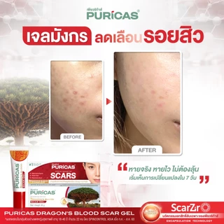 เซ็ตใหญ่ ลดเลือนรอยดำรอยแดง Puricas Scar Gel 20g + Intensive Dark Spot 20g.