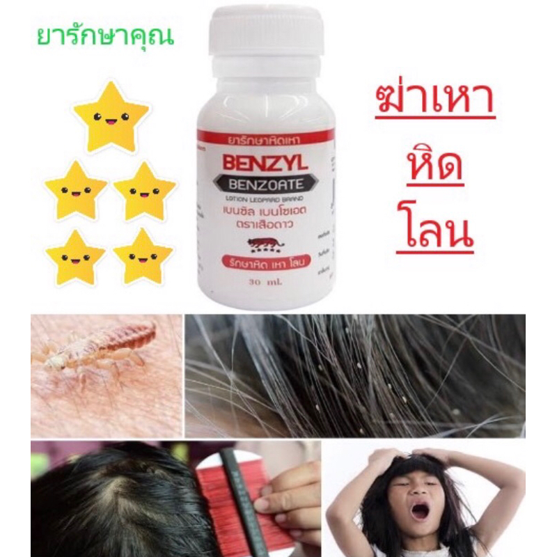 Benzyl ยาน้ำรักษา เหา หิด โลน 30ml