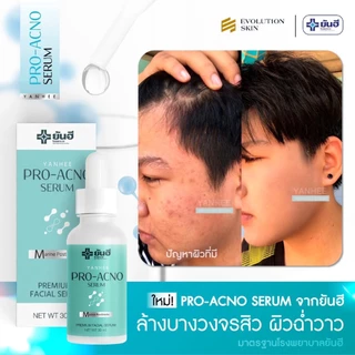 Yanhee Pro Acno Serum [1 ขวด] ยันฮี โปร-เอกโน่ เซรั่มยันฮีลดสิว ลดรอยดำจากสิว ลดรอยแดงจากสิว ลดสิวอักเสบ ผิวแพ้ง่าย