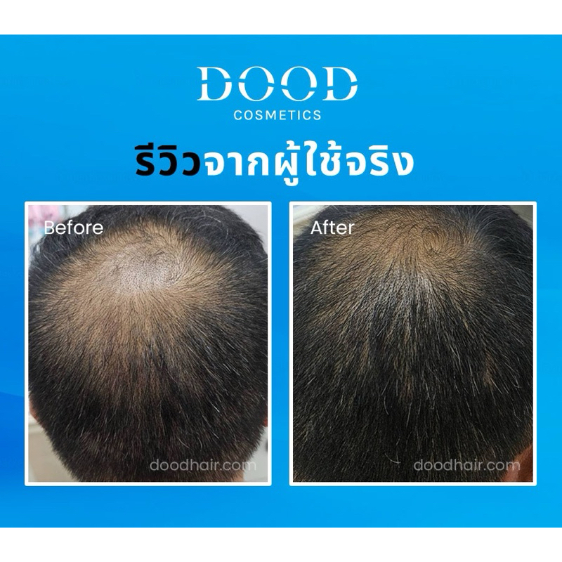 ครีมนวดสูตรแพทย์ผิวหนัง ไม่ต้องล้างออก 100 กรัม ช่วยผมดกดำ ลดกลิ่นหัวเหม็น ลดผมร่วง สร้างผมใหม่เห็นผลทันใจ