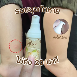 (สินค้าขายดี) KHUN คุน ยาทายุงกัดเด็ก ลดรอยดำ ลดคัน บวมแดงหายไว สำหรับเด็ก กันยุงเด็ก ทาหลังยุงกัด