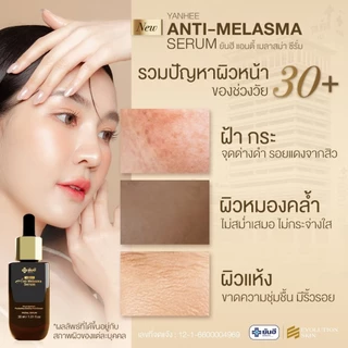 YANHEE ANTI MELASMA SERUM [ 1 ขวด ] ยันฮี แอนตี้ เมลาสม่า เซรั่มลด ฝ้า กระ ลดจุดด่างดำ แก้ฝ้า ผิวกระจ่างใส ผลัดเซลล์ผิว