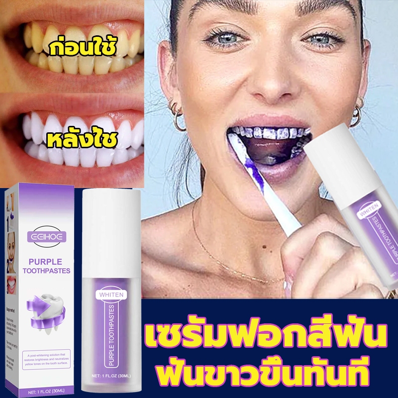 พิเศษสําหรับฟันเหลือง EELHOE V34 ยาสีฟันฟันขาว ยาสีฟัน การฟอกสีฟันสีม่วง กำจัดกลิ่นปาก ลดคราบหินปูน ฟอกฟัน ฟอกฟันขาว