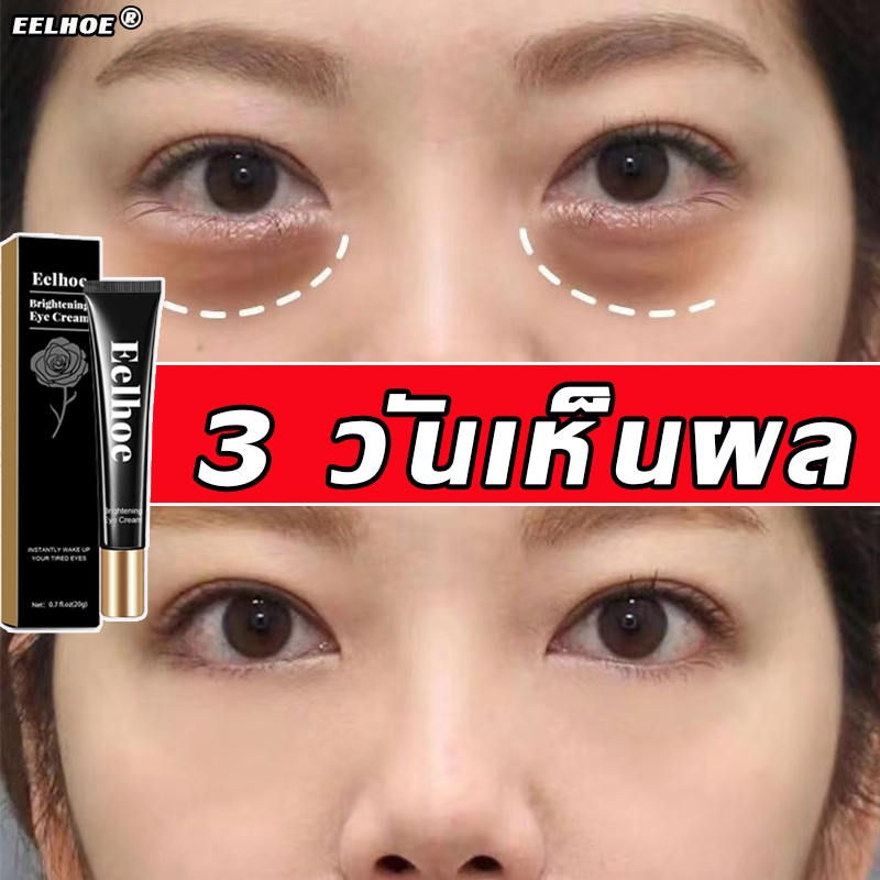 อายครีม 20g retinol  ครีมลบถุงใต้ตา กระชับ ยกกระชับ ลดรอยคล้ำใต้ตาลดถุงใต้ตาบวม บำรุงรอบดวงตาบำร คงความชุ่นชื้น ลดเลือนร