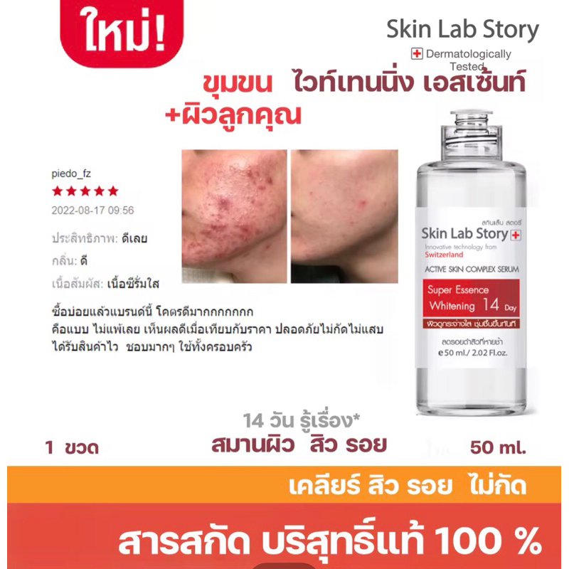 Skin Lab Story สกินแล็บ สตอรี่ L6 เอสเซ้นท์ หน้าใสจุกๆ ฆ่าสิวรอยสิว อาจยิบๆได้สำหรับคนที่ผิวบางไว้ฆ่าเชื้อสิว**50 มล