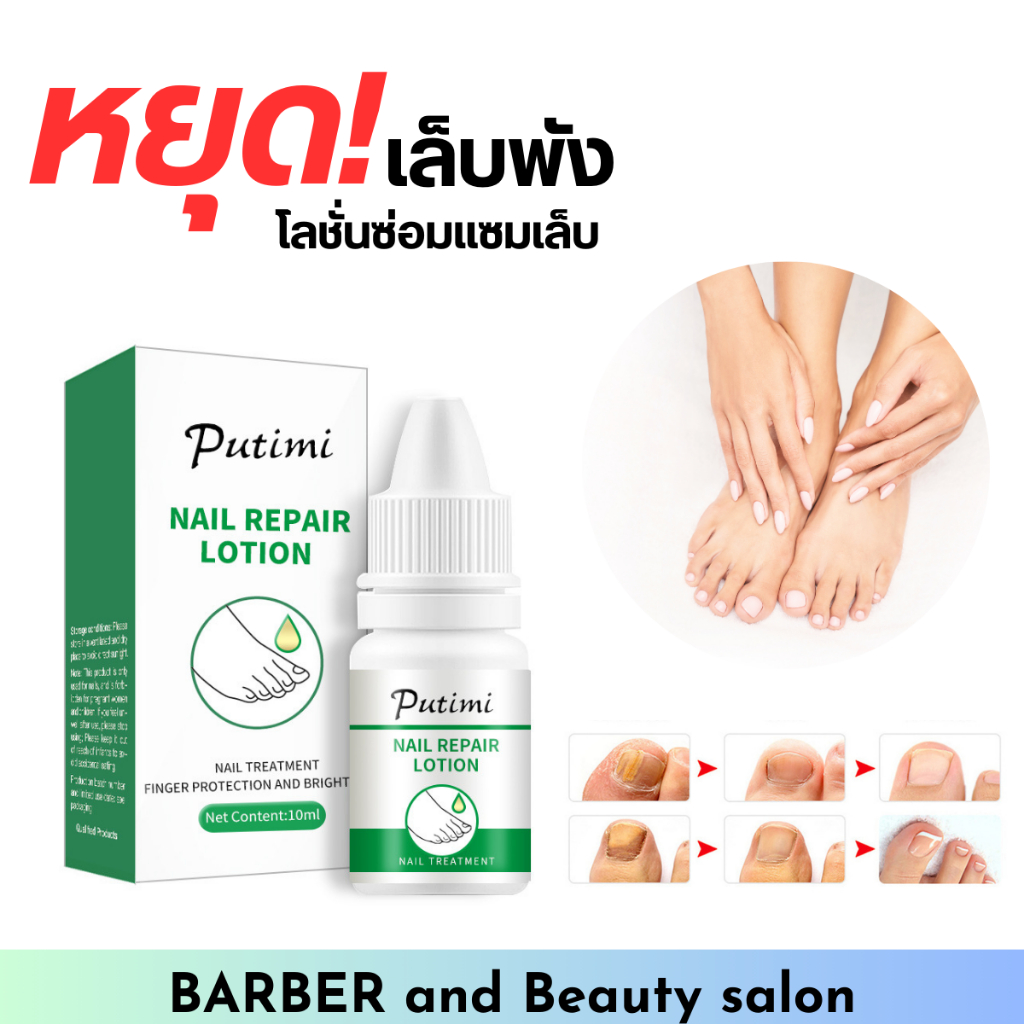 น้ำยาการรักษาเชื้อราที่เล็บ Putimi Nail Care Solution สำหรับเท้าเจลเซรั่มกำจัดเชื้อรานิ้วป้องกันการติดเชื้อ