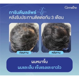 ไบโอติน เอช แมกซ์ 900 กิฟฟารีน ผลิตภัณฑ์เสริมอาหารไบโอติน ผสมสารสกัดฮอร์สเทล โปรตีนจากถั่วเหลือง