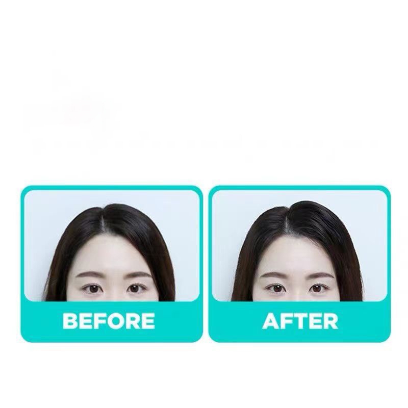 พร้อมส่ง : กิ๊บ ที่ยกโคนผม เสริมโคน เพิ่มความมั่นใจ ซี่หวีไม่เจ็บศีรษะ มี 3 สี น้ำหนักเบา น่ารักมีสไตล์ ราคา ถูกที่สุด ดีลบีเคเค แกลเลอรีภาพที่ 3