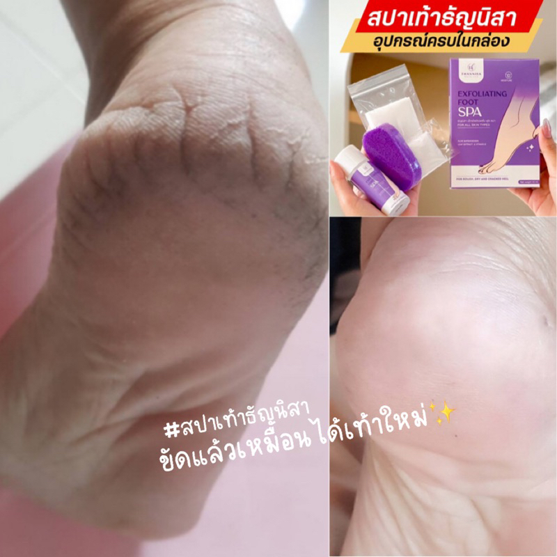 🔥199฿ ‼️ สปาเท้าขัดเท้าธัญนิสา‼️น้ำยา สำลี ถุงมือ โฟมขัด