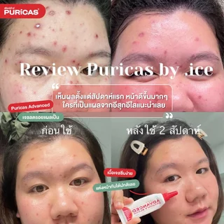 Puricas Plus Advanced Dragon's Blood C&E Scar Gel 3g. (ขนาดทดลอง) เจลลดรอยแผลเป็น