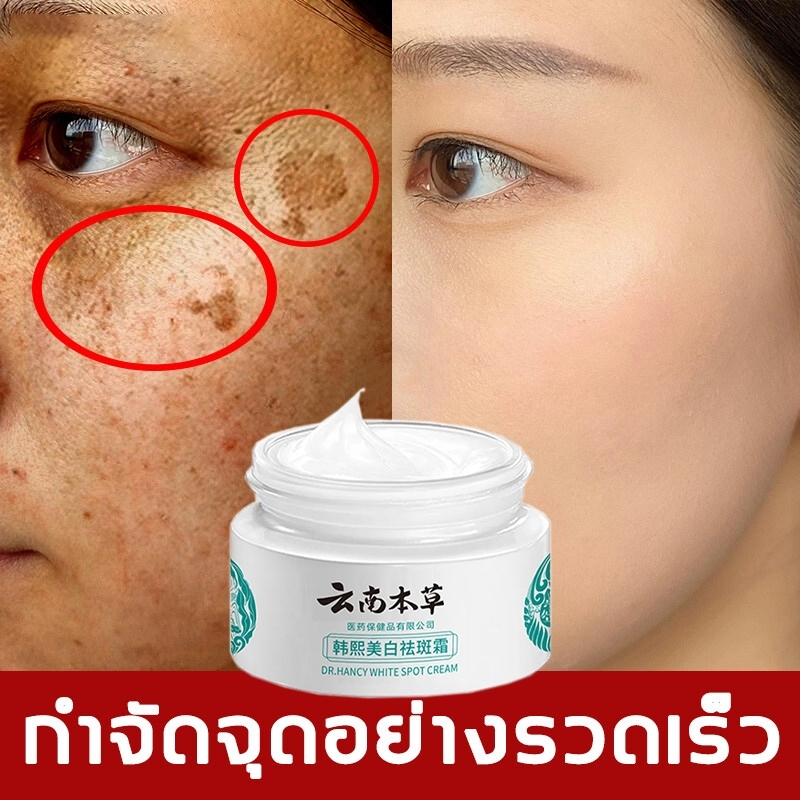 【COD】Freckle and whitening cream ครีมแก้ฝ้าถาวร ครีมทาฝ้ากระ ซ่อมแซมฟื้นฟูผิว ดูกระจ่างผิวใส ทาฝ้าหนาลึก ครีมกน้าขาวใส