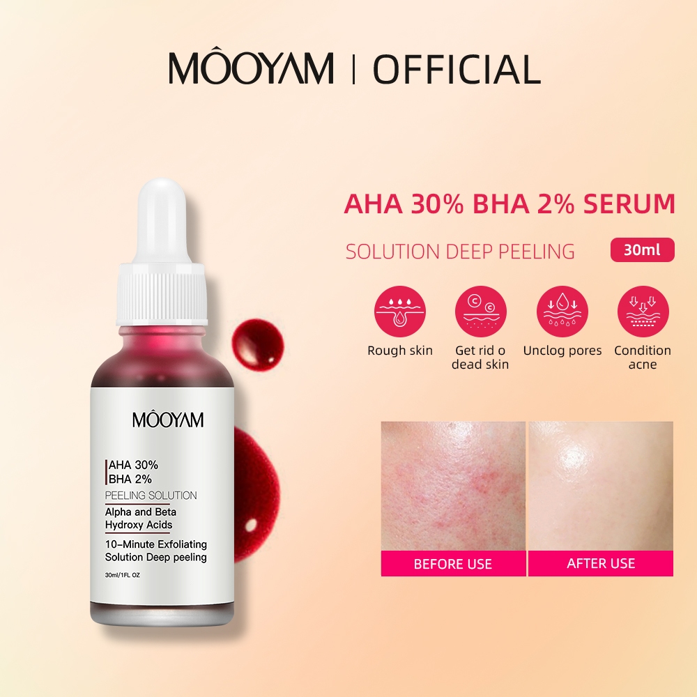MOOYAM เซรั่มมาส์กแดง ขัดผิวเซรั่ม กรด Salicylic กรดผลไม้ ลดสิว AHA 30% + BHA 2% Serum 30ML aha bha serum