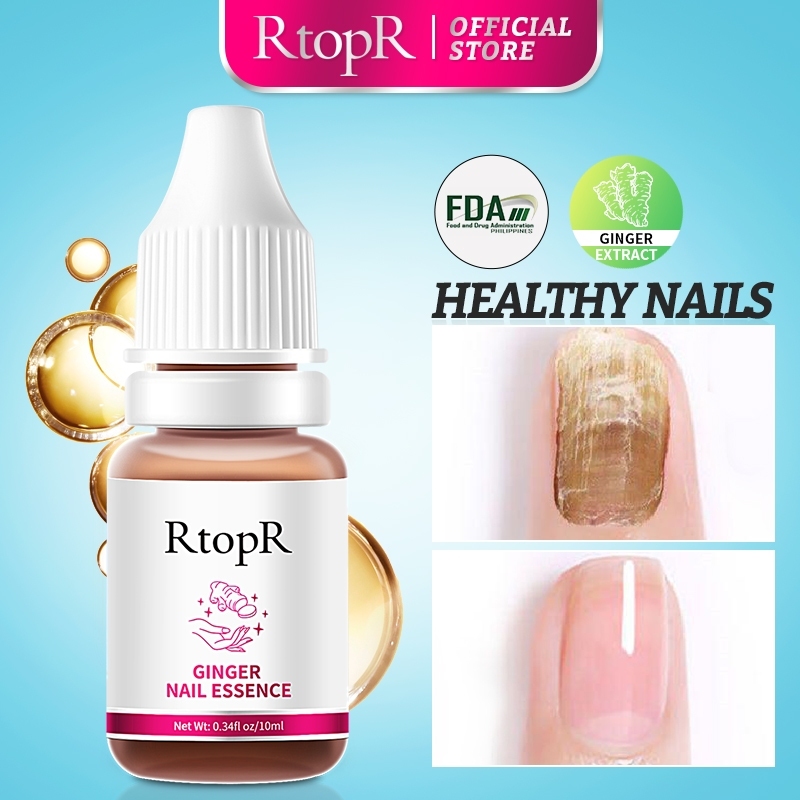 RtopR FDA ยาทาเล็บ ขิง เซรั่มรักษาเล็บ เซรั่มซ่อมเซมเล็บ ยาทาเล็บป้องกันเชื้อแบคทีเรีย 10 มล.