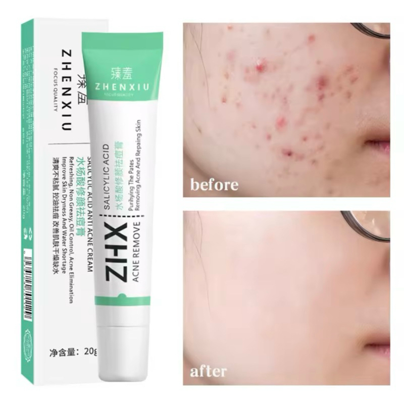 [🕸️พร้อมส่ง] ครีมบำรุงผิว ดูแลสิว ZHENXIU✅  SALICYLIC ACID ZHX Acne Remove