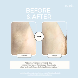 PADDIES - Fluffy Clouds Daily Brightening Pad ( 3 ซอง ) | โทนเนอร์แพดผิวกาย | ระงับกลิ่นใต้วงแขน | ดูแลหัวเข่า ข้อศอก