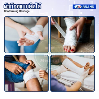 ผ้าก๊อซยืด ผ้าก๊อซพันแผล ZD conforming bandage เนื้อนุ่ม ซึมซับดี (บรรจุ 12 ม้วน/แพ็ค)