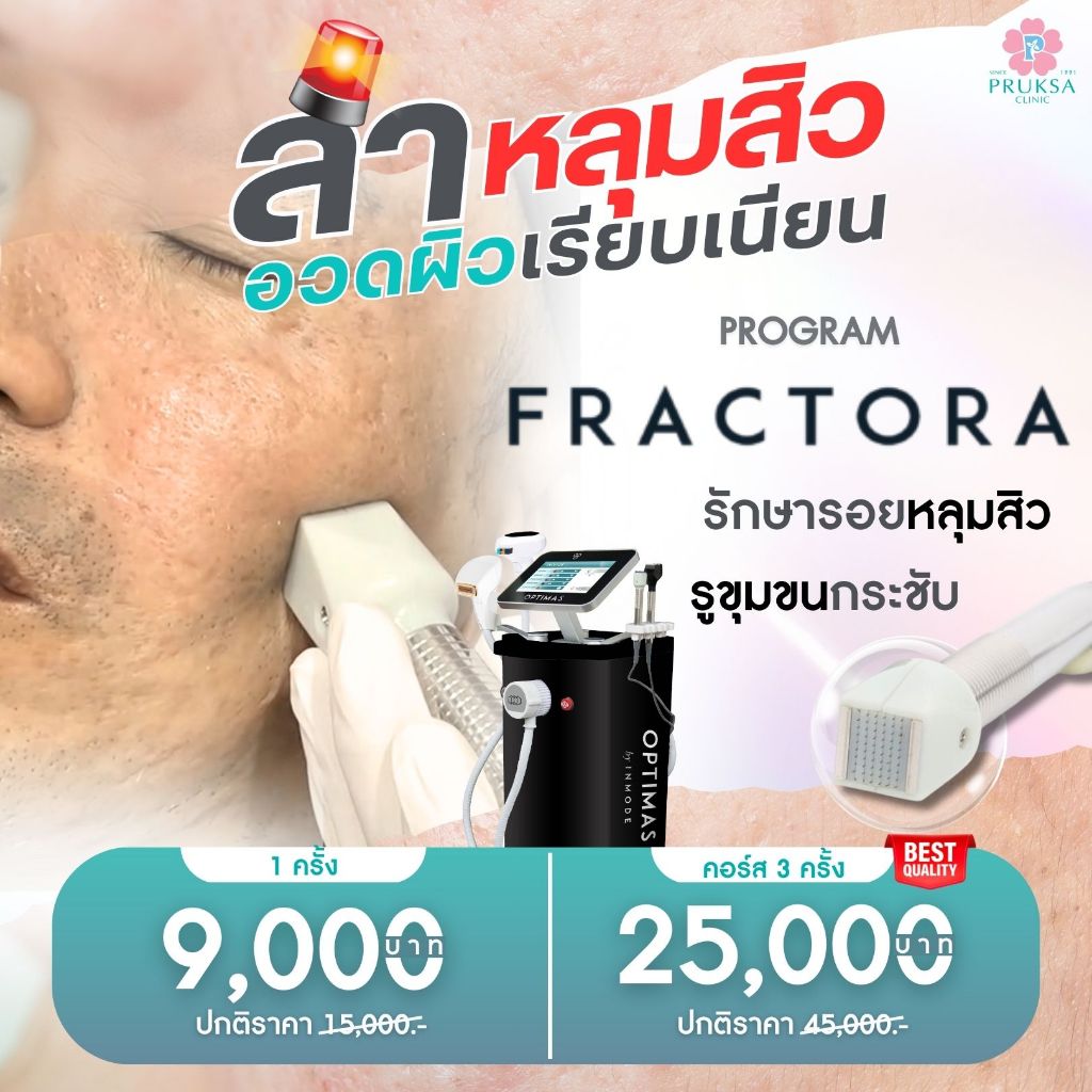 Pruksa Clinic โปรแกรม Fractora รักษาหลุมสิว รูขุมขนกระชับ เรียบเนียน