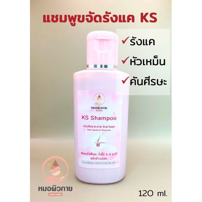 แชมพูขจัดรังแค KS รักษารังแค คันศีรษะ หนังศีรษะมัน หนังศีรษะมีกลิ่น