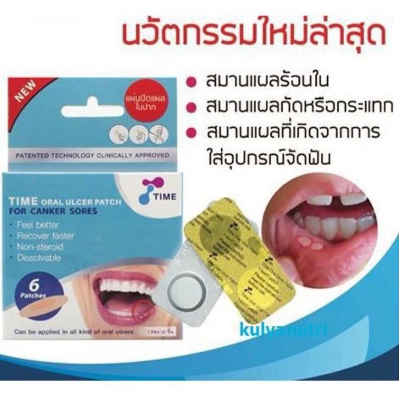 แผ่นแปะร้อนในแบบละลาย TIME ORAL ULCER PATCH ร้อนใน รุ่นกล่อง บรรจุ 6 ชิ้น แผลในปาก แผ่นปิดแผลในปาก