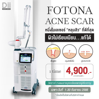 [E-voucher] Dii Aesthetic : Fotona Scar 1Time รักษาหลุมสิว