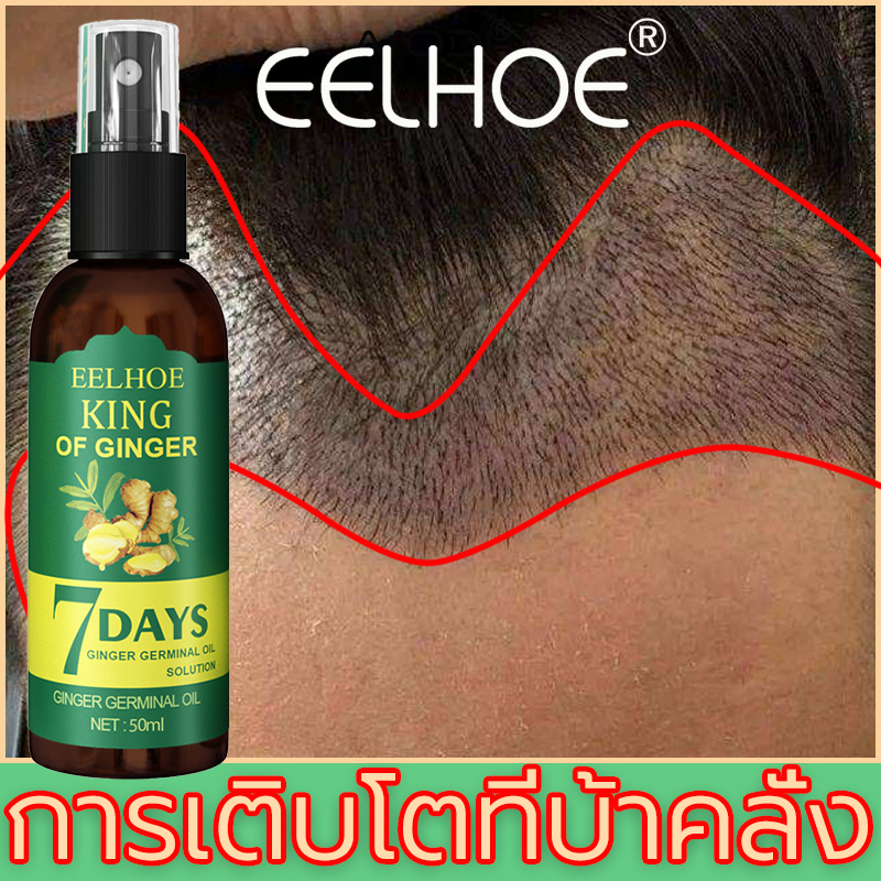 จัดส่งทันที ของแท้ EELHOE เอสเซ้นส์ผม ปลูกไรผม เซรั่มปลูกผม น้ำยาเร่งผมยาว ปลูกผมของแท้ ปลูกผมเร่งด่วน
