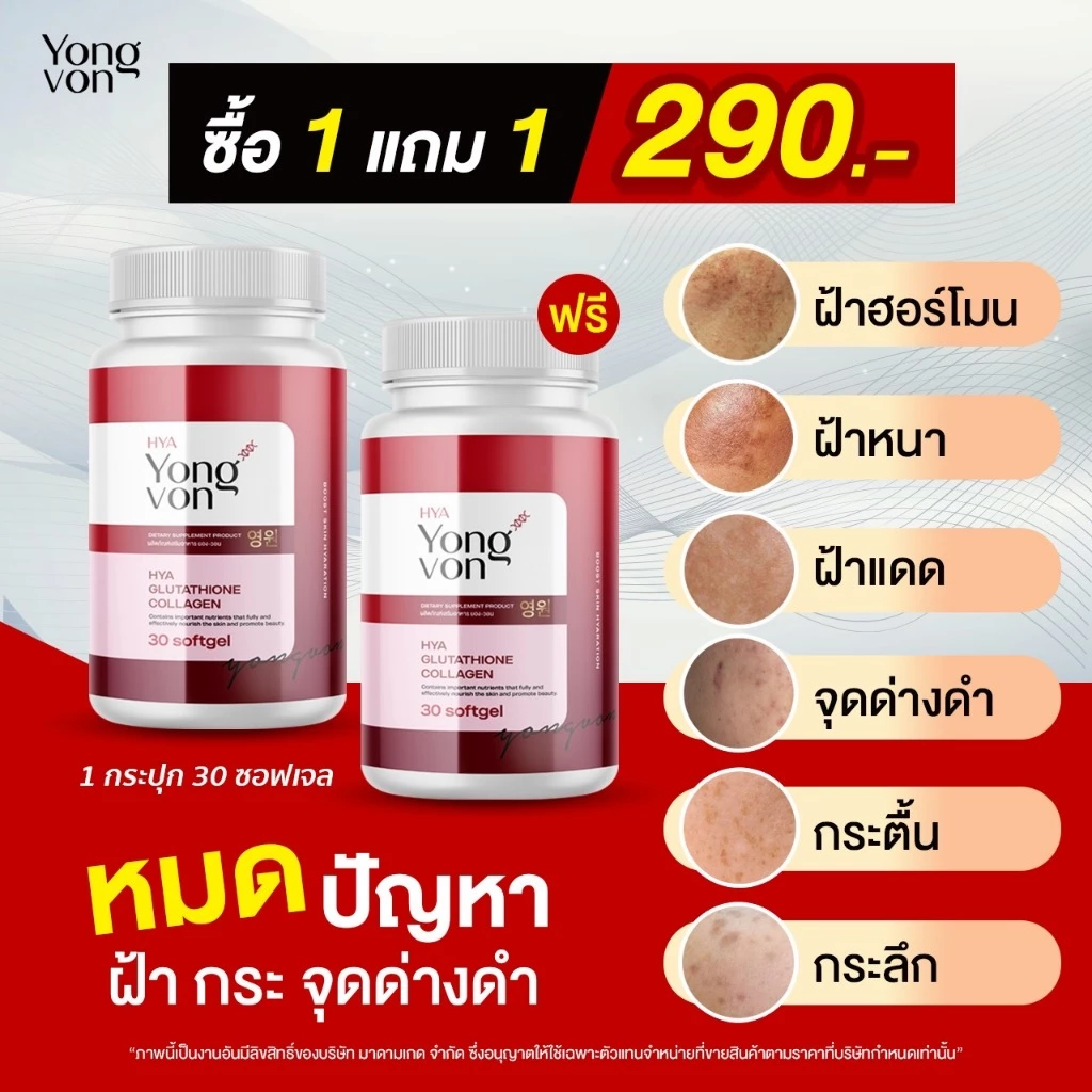 Yong-Von กลูต้า จบปัญหาสิวรอยดำ ผิวสุขภาพดี thumbnail 7
