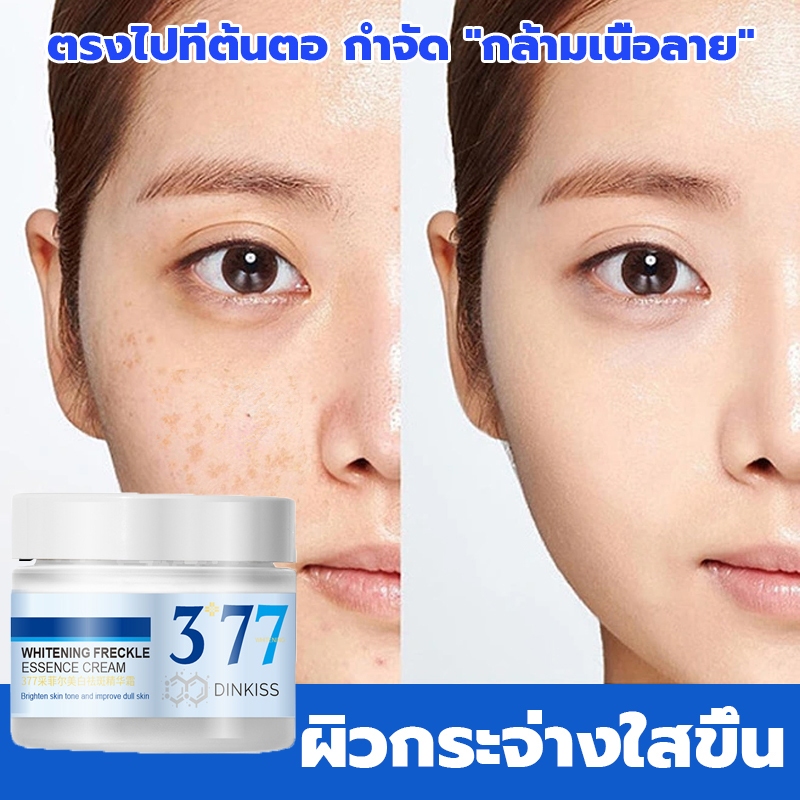 DinKiss377ครีมทาฝ้า ไวท์เทนนิ่งครีมกระ การกำจัดที่มีประสิทธิภาพ ฝ้า กระ จุดด่างดำ จุดอายุ ปรับความหม