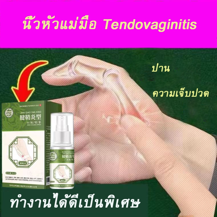 apgar30 มลสเปรย์รักษาเอ็นอักเสบที่ข้อมือ แก้ปวดส้นเท้า โรคไขข้ออักเสบ สเปรย์เจลบรรเทาอาการปวดส้นเท้า