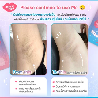 Blow Kiss “Underarm Sheet Mask” แผ่นมาส์กสำหรับรักแร้ เพื่อรักแร้เรียบเนียน ขาวกระจ่างใส ไร้กลิ่น