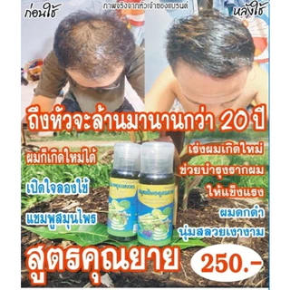 พร้อมส่ง🐧แชมพูแก้ผมบาง [มีของแถม] สูตรสมุนไพร 17 ชนิด ยาสระผมสมุนไพร แชมพูสมุนไพรคุณยาย สูตรคุณยาย
