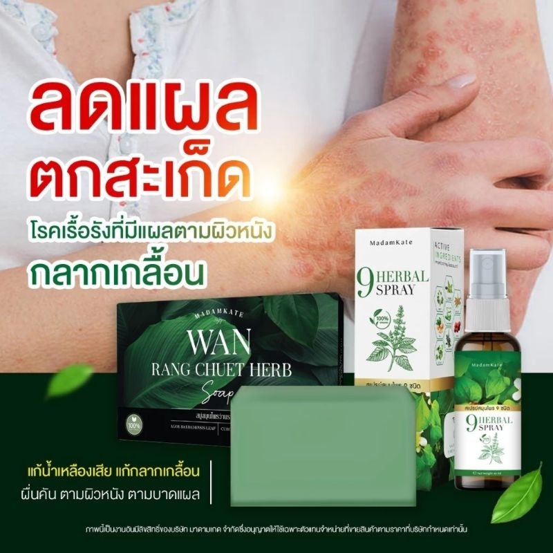 พร้อมส่ง สบู่ว่านรางจืดเชื้อรา กลากเกลื้อน แพ้เหงื่อ ลมพิษ ผดผื่น