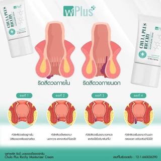 จุฬาพลัส ครีมทาริดสีดวงCHULA PLUS RICCHY MOISTURIZER CREAM