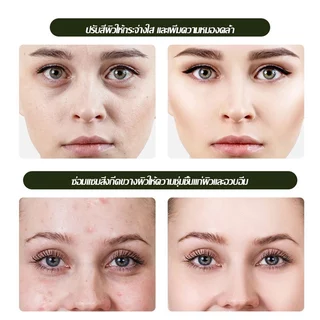 SKAT เซรั่มจากสารสกัดทีทรีเข้มข้ม ช่วยบำรุงผิวหน้า Tea Tree Essential Serum 50ml-1503