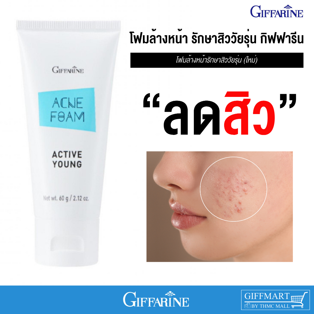 โฟมล้างหน้าสิว โฟมล้างหน้ารักษาสิว แอคเน่ แอคทีฟยังกิฟฟารีน โฟมสิว Active Young Acne Foam Giffarine