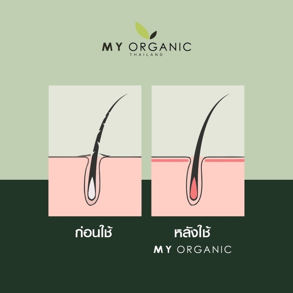 [สูตรใหม่+โปรโมชั่น] My organic Hair tonic ออร์แกนิคโทนิค เซรั่มบำรุงผม ลดผมหงอก ผมร่วง - รูปที่ 4