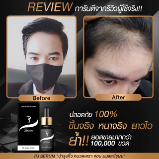 PJ SERUM โปร 5 ขวดเซรั่มบำรุงและปลูก คิ้ว หนวด จอน ผม จบในขวดเดียว #ของแท้