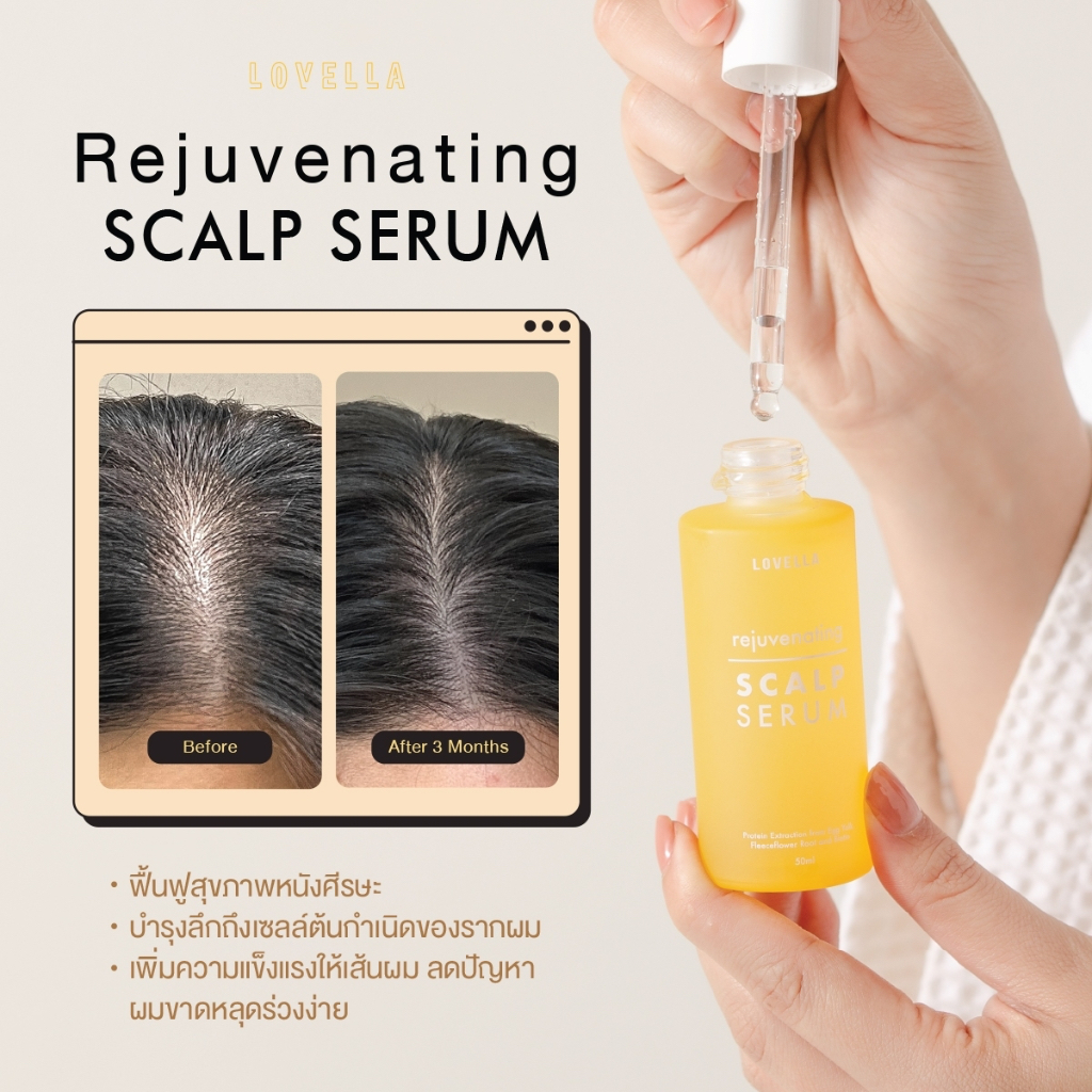 เซรั่มบำรุงหนังศีรษะ - หยุดผมร่วง แก้ปัญหาผมบาง ช่วยให้ผมหนาขึ้น - ดูแล ฟื้นฟู และบำรุงสุขภาพหนังศีรษะกับรากผม