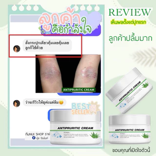 ANTIPRURITIC CREAMครีมแก้คันแกแพ้